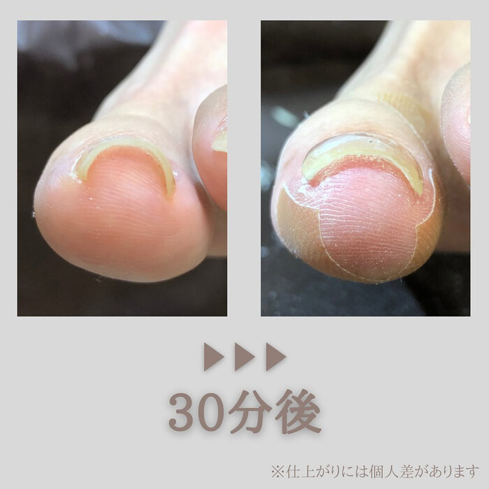 画像306