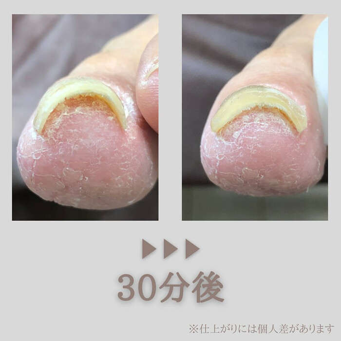 画像314