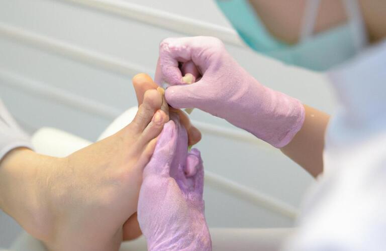 痛みや食い込みが気になる足の不安を解消！巻き爪矯正のプロがお手伝い